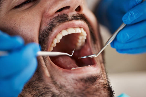 Best Emergency Dental Services for Seniors in Portage, IN